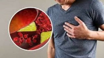 اكتشاف مذهل: عشبة غير متوقعة تحل مشاكل النظر وتخفض الكوليسترول!